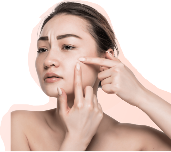 microdermabrasion