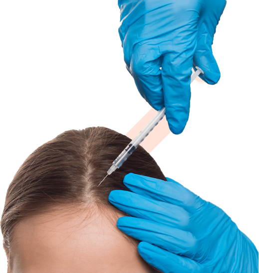  Meso scalp Treatment
